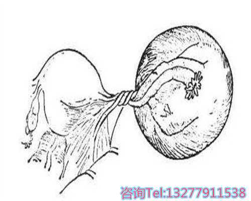 今典手机如何上网
