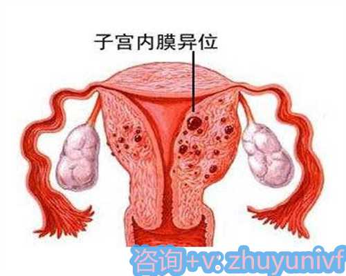 佛山代怀中介_佛山不孕不育试管医院排名最好，本地人首选市妇幼保健院！